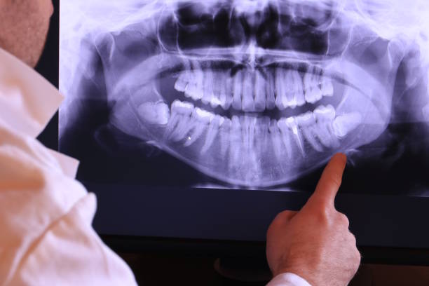 Best Emergency Dental Services Near Me  in Mountainside, NJ