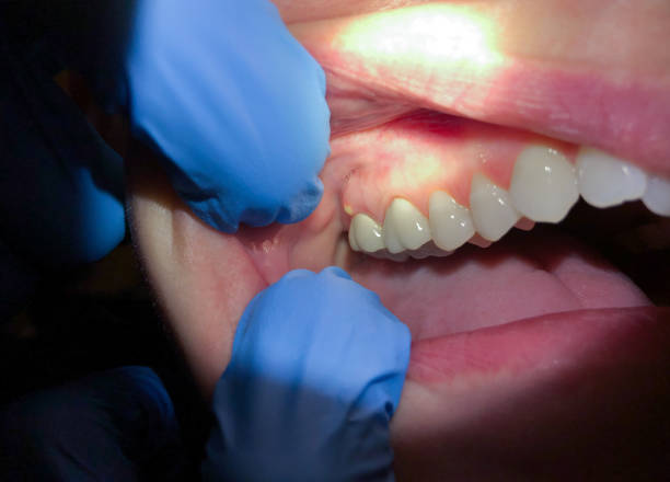 Best Knocked-Out Tooth Emergency  in Mountainside, NJ